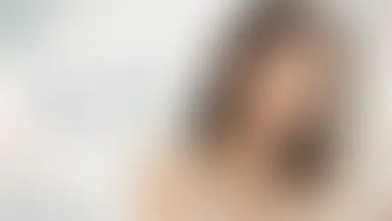 痘印、痘疤與凹洞,並不一樣