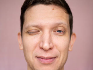 Man with one eye open and one eye closed