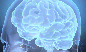 brain-GIF-Univ-of-California-SF.gif