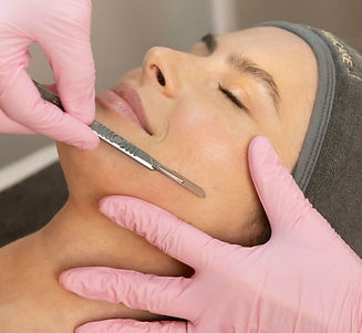 DERMAPLANING.jpeg
