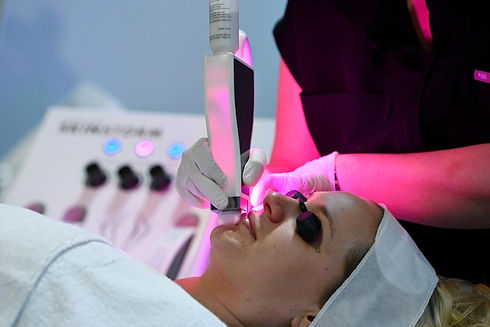 Skinstorm treatment.JPG