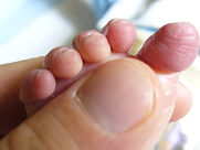 neues Leben begrüßen