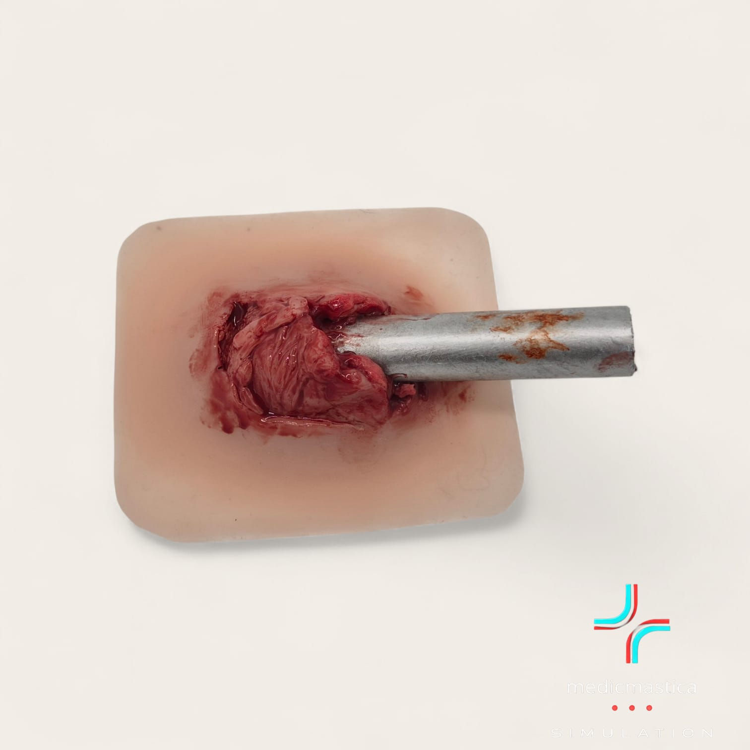 Wundmoulage "Pfählungsverletzung"