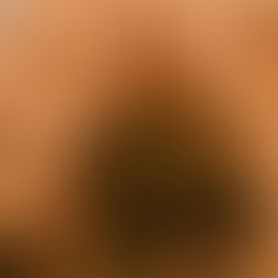 The Last Sentinel: Beware of this Turkey 🦃 it Stinks!!