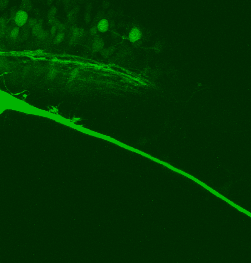 Axon Outgrowth