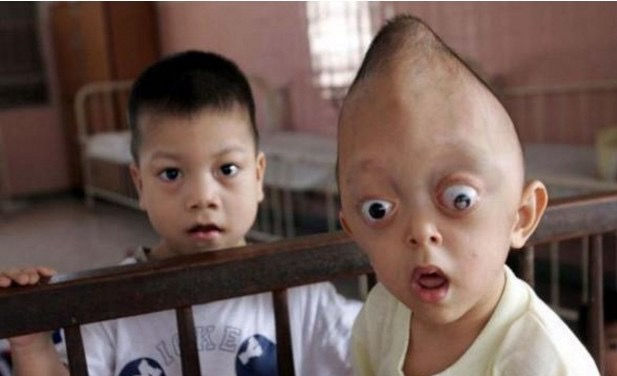 Agent Orange Caused Birth Defects