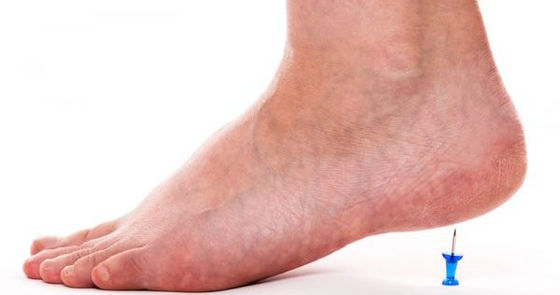 Plantar Fasciitis planting you in a chair?
