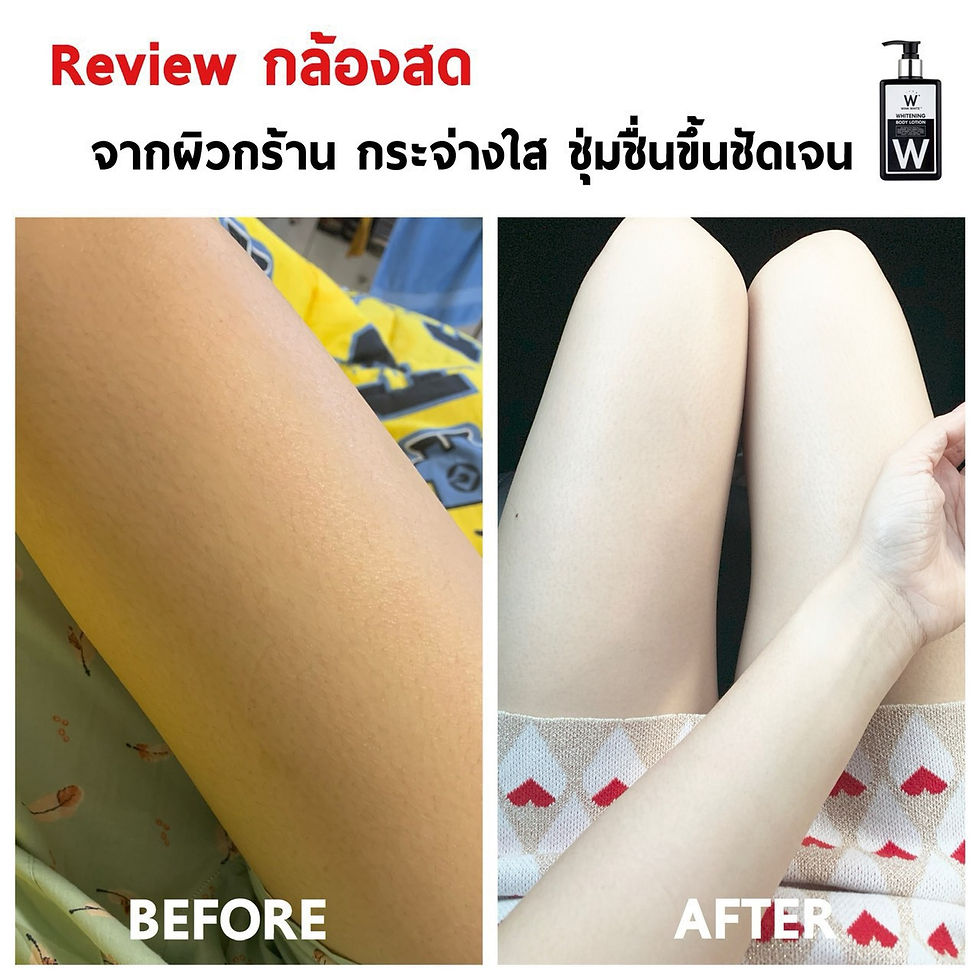 ภาพขนาดย่อ: เซ็ตผิวกระจ่างใส ออร่า✨สบู่ โลชั่น