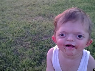 When People Saw This Little Angel, They Were Scared. Until His Mom Told Them THIS!