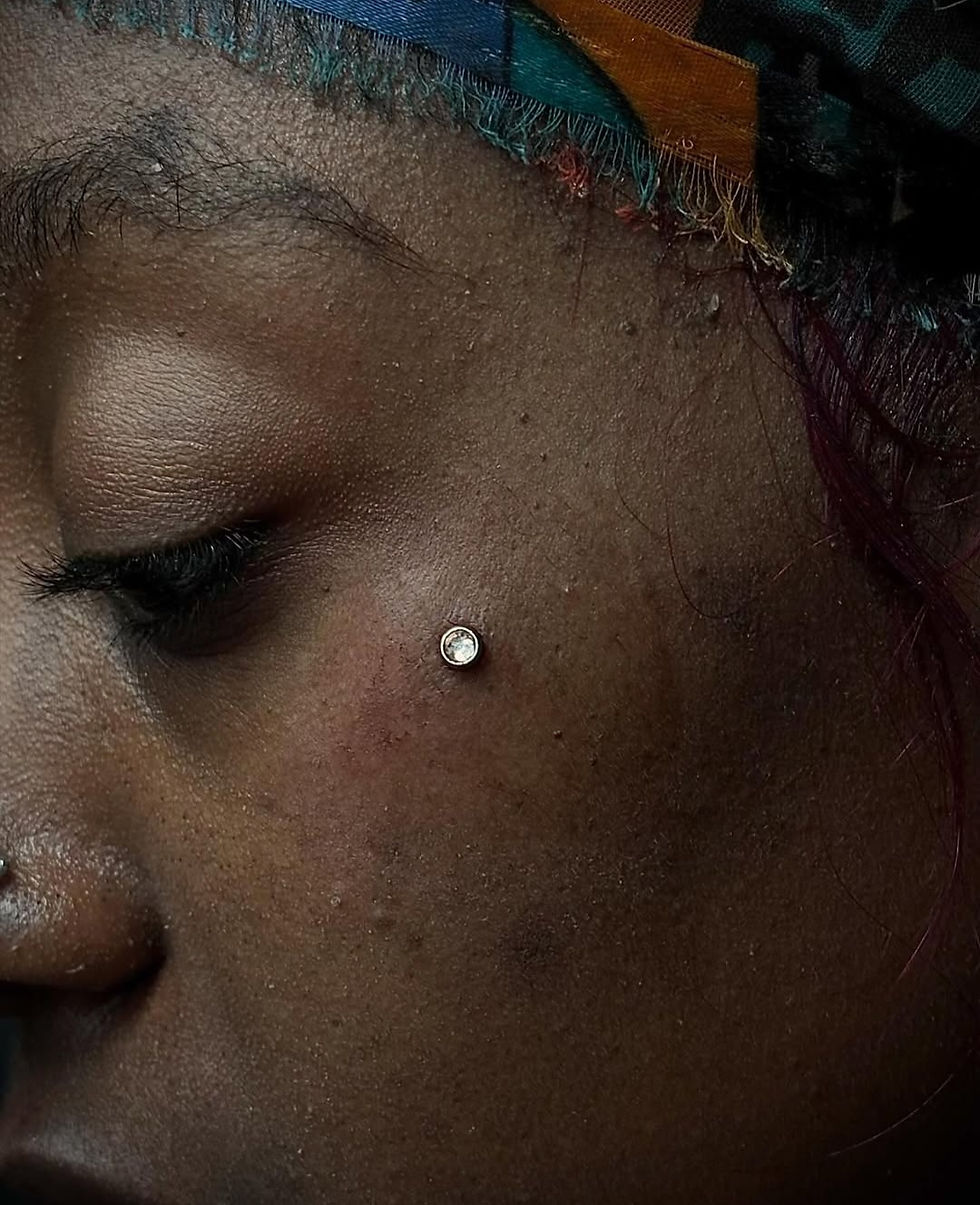 Face Dermal