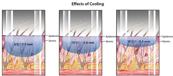 Effects Of Cooling