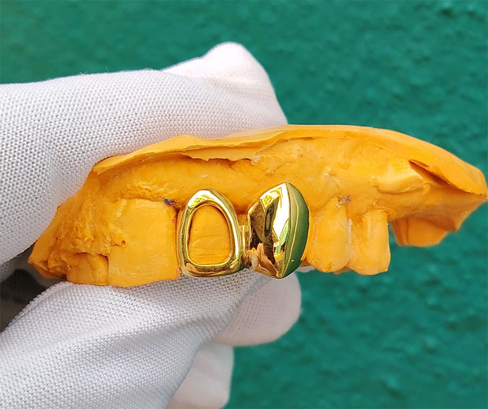 Custom gold grillz Cape Town