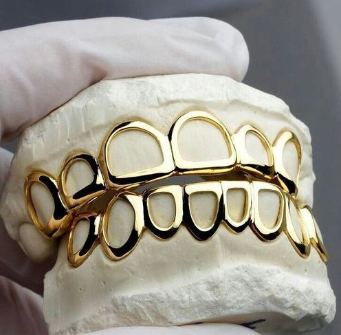 gold grillz.jpg