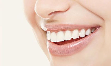 Partial dentures