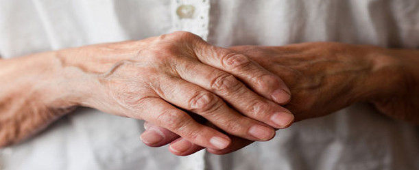 Arthritis-in-hands-5