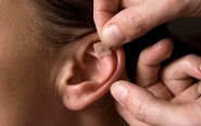 auricular