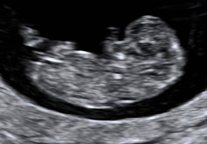 Early viability scan