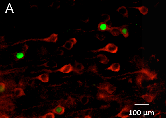 New paper published: Nicotine facilitates the transition to alcohol dependence through dysfunction o