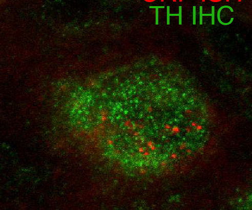 New paper published by the George Lab: Identification of a new type of neurons that contributes to n