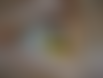 10 SIGNS YOU SHOULD INVEST IN KERATOCONUS TREATMENT