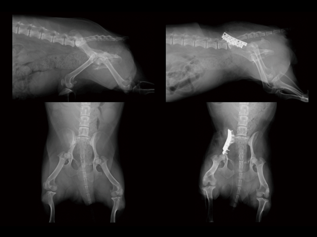 Pelvic Fracture