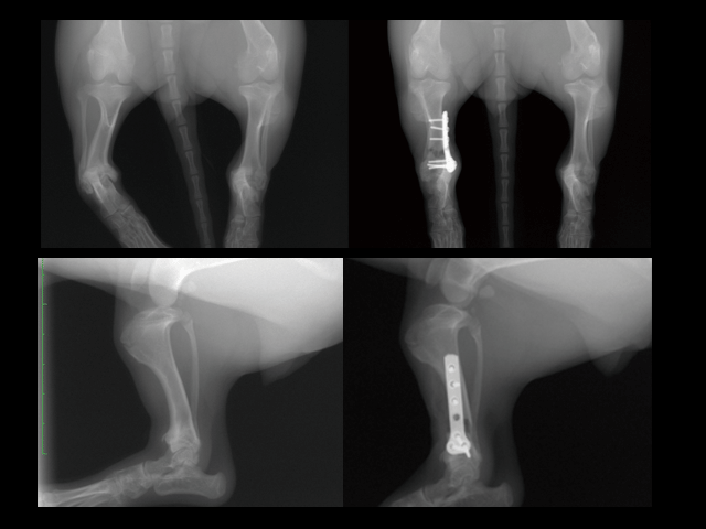 Right side Metaphyseal dysplasia