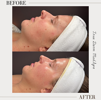 Glow Getter Facial treatment featuring hydrating enzymes, LED therapy, and a rejuvenating mask to boost radiance and restore