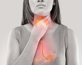 Heartburn and Reflux Guide