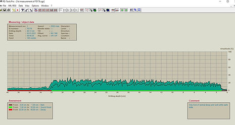 Resistograph readout