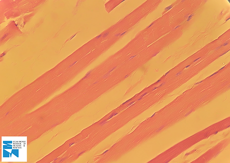 MÚSCULO - Esquelético (longitudinal)3.png