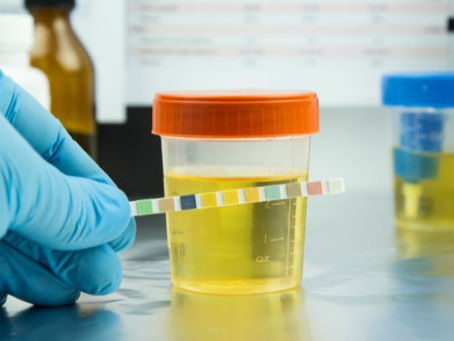 dot post accident drug testing