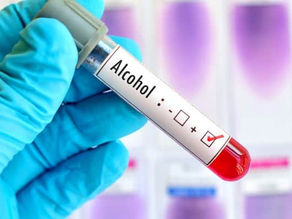The Ultimate Guide to Instant Drug and Alcohol Testing: Tips, Methods & What to Know