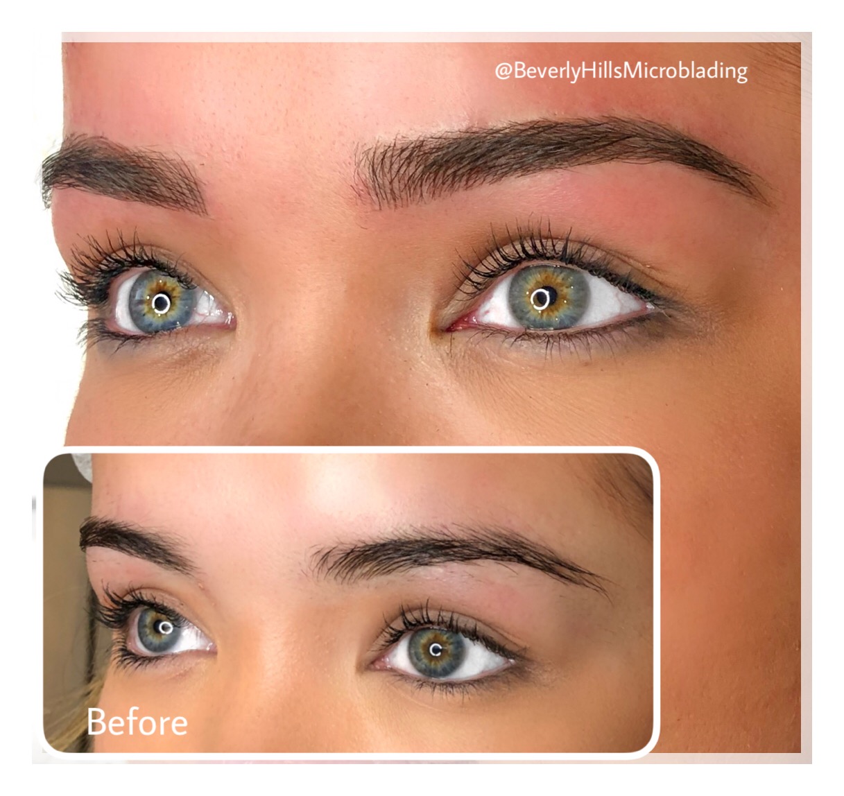 Beverly Hills Microblading Services