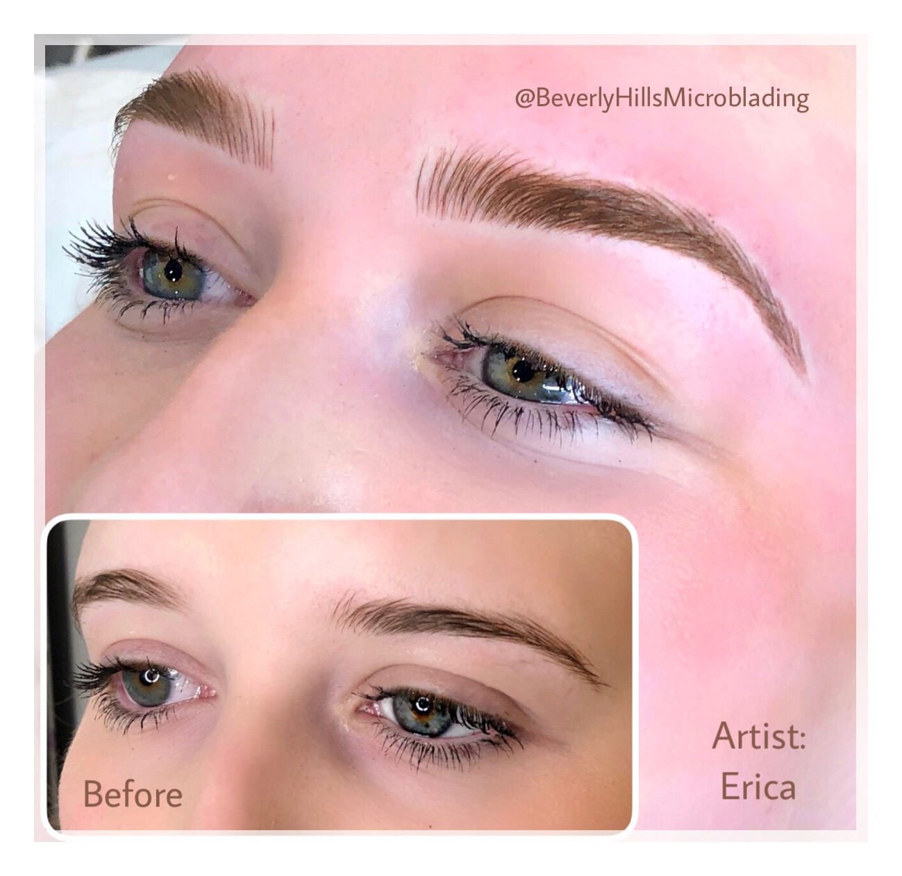 Beverly Hills Microblading Services