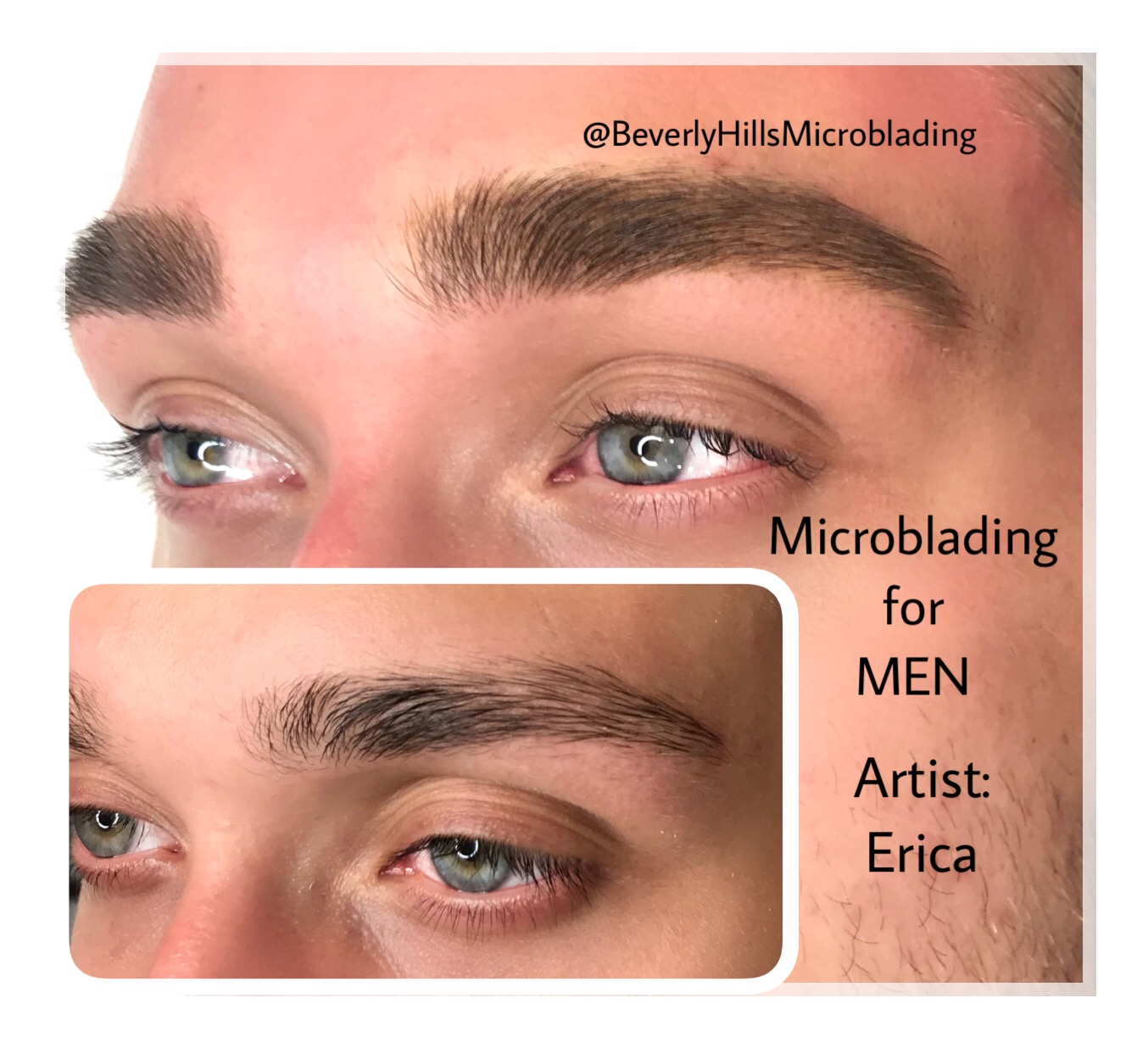 Beverly Hills Microblading Services