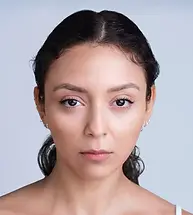 astrid-front-after-4wk_2x.webp