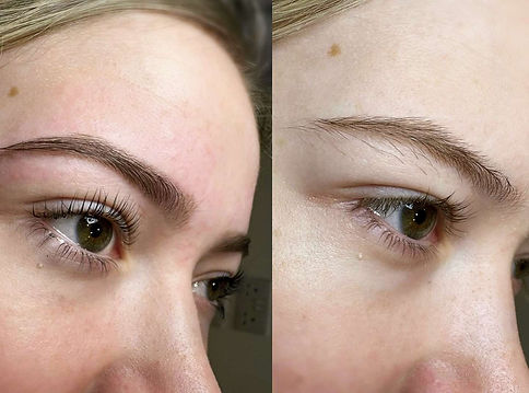 Close up comparison of a woman's eyebrows before and after professional shaping and microblading
