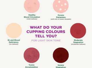 What do the Cupping Marks and Colors Mean?