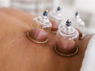 What is Cupping and How Is It Related to Acupuncture?