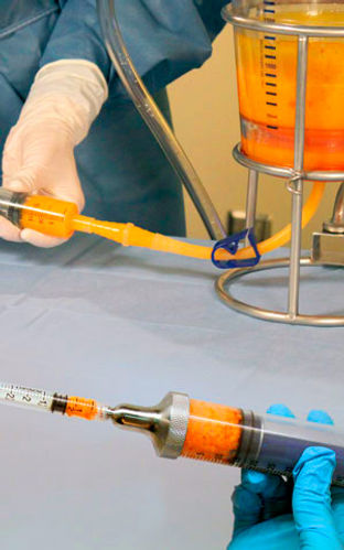 microaire-lipofilter-fat-transfer.jpg