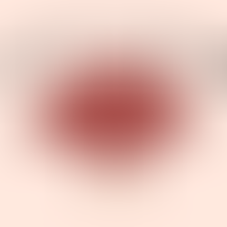 Physical Activity on Mental Health