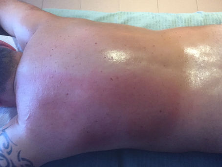 ISTAMINA: un test efficace per valutare la presenza di stress a livello connettivale