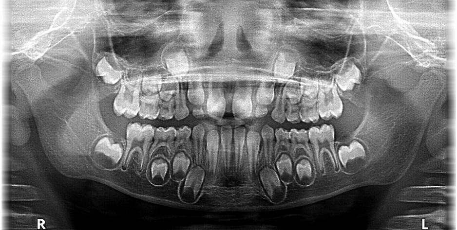 Vale a pena comprar uma radiografia panorâmica para sua clínica odontológica