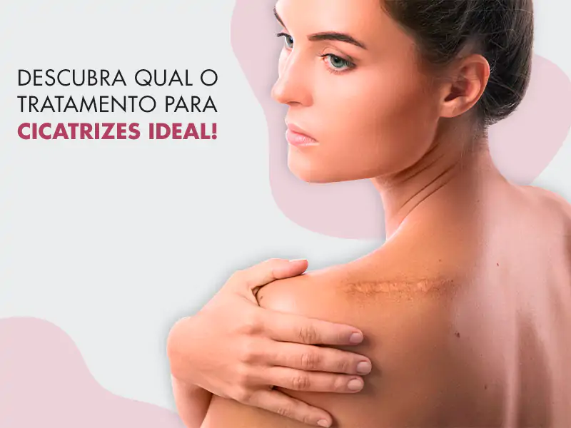 Cicatrizes.webp