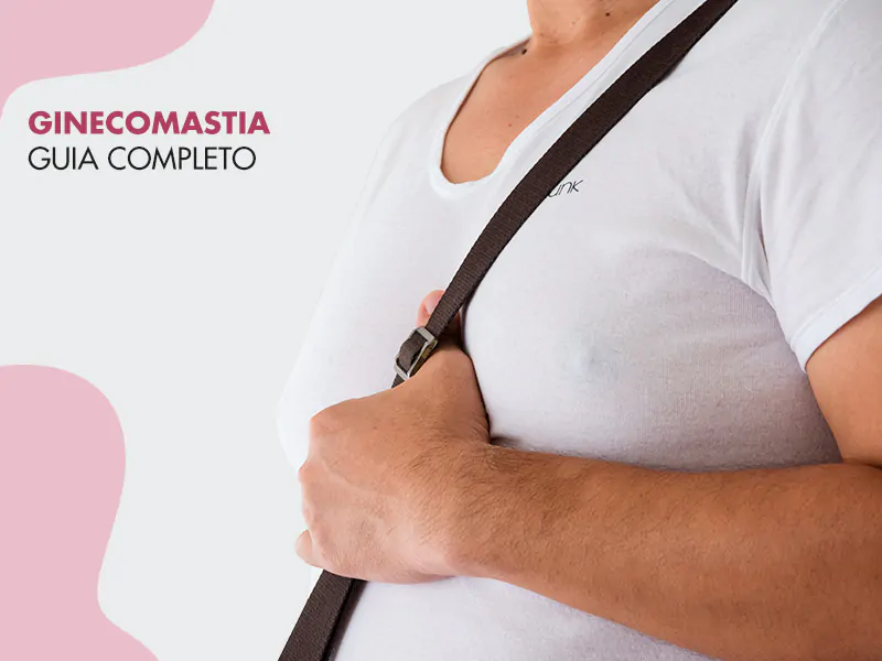 Ginecomastia.webp
