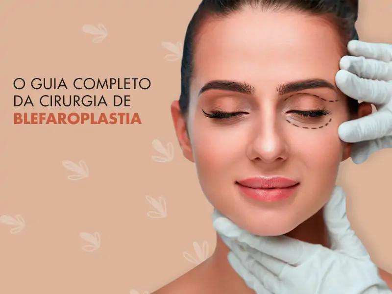 Blefaroplastia.webp