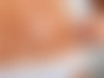 Top Scar Removal Treatments in Las Vegas: Get Your Confidence Back