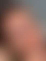 Why Your Face Never Feels Finished (Even After Regular Appointments)