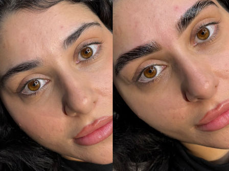 South Yarra vs Toorak Beauty Culture: What Brows Reveal About Lifestyle