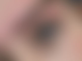 The Truth About Lash Lifts: Why Results Vary So Much